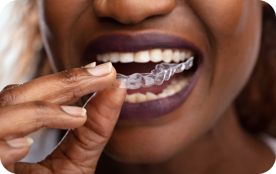 Invisalign près de Monaco